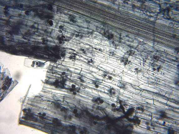 File:Arbuscular mycorrhiza microscope.jpg